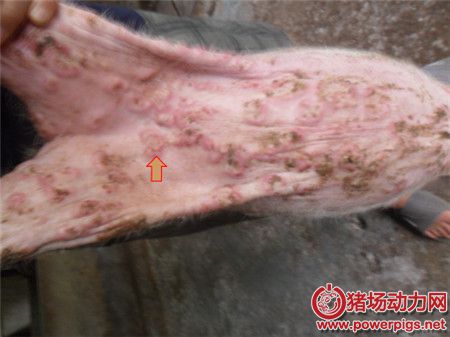 图9:皮肤癣菌病(毛癣菌病)